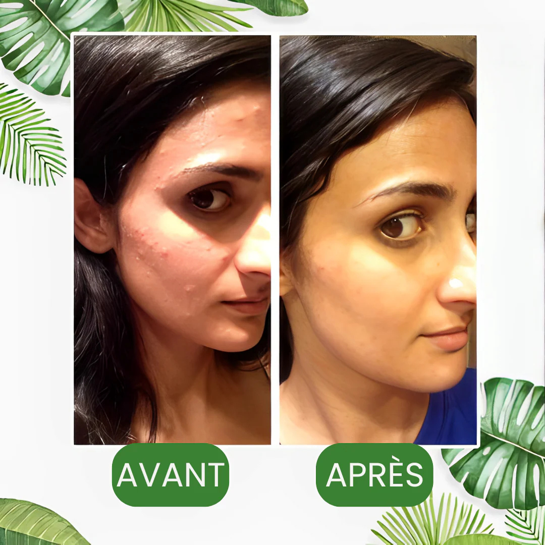 Masque nettoyant anti-points noirs