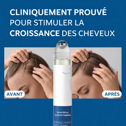 Sérum Roll-On Croissance Capillaire