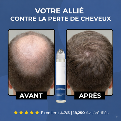 Sérum Roll-On Croissance Capillaire